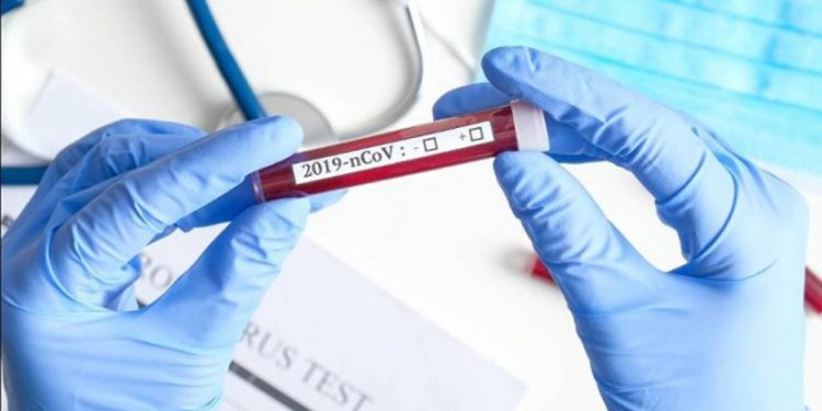 सुदूरपश्चिमका नयाँ सङ्क्रमित सबै बैतडीका