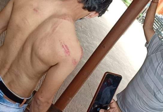 प्रहरीबाट कुटिए जनकपुरका व्यापारी, व्यापारीलाई जथाभावी कुटपिट गर्ने प्रहरी कारबाहीमा