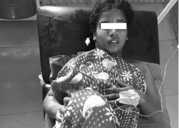 जनकपुरकी एक जना महिलामाथि एसिड प्रहार,महिलामाथि एसिड प्रहार गरेको आरोपमा श्रीमान पक्राउ