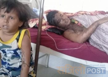 जनकपुरकि एसिड पीडित आरती भन्छिन् : पहिला पनि मट्टीतेल खन्याएका थिए