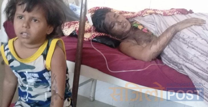 जनकपुरकि एसिड पीडित आरती भन्छिन् : पहिला पनि मट्टीतेल खन्याएका थिए