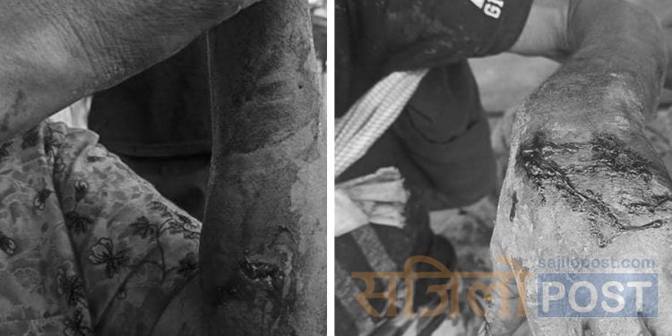 पर्सामा भालुको आक्रमणबाट एक दम्पत्ति घाइते