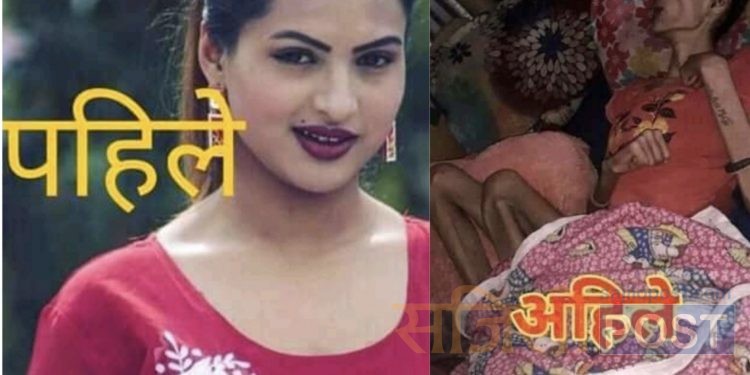 चलचित्र “मधेशी पुत्र २” का अभिनेत्री निशा घिमिरेकी अवस्था गम्भीर,सहयोगका लागि अपेक्षा