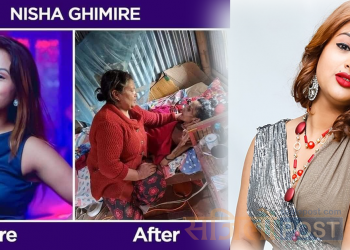 उपचार पाएपछि मोडेल तथा अभिनेत्री निशाको अनुहारमा चमक ! उनी कसरी पुगिन यस्तो अबस्थामा