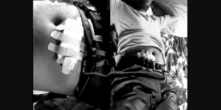 महोत्तरी : घरमै पसेर छुरा प्रहार, एक जना आरोपी प्रहरी नियन्त्रणमा