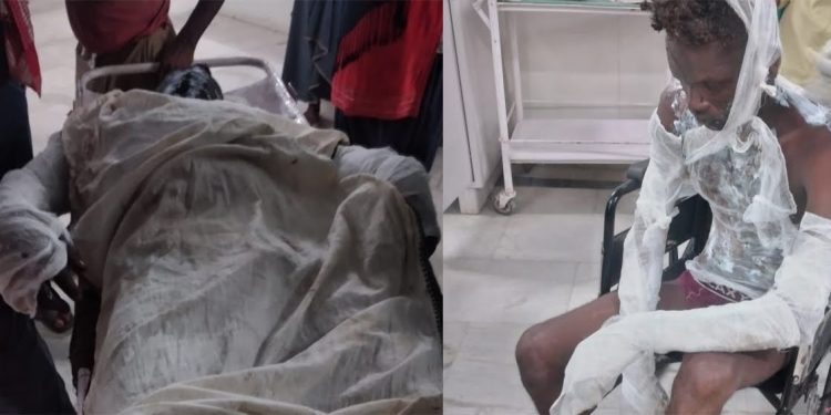 सामूहिक बला त्कारका आरोपीलाई जिउँदै जलाइयो