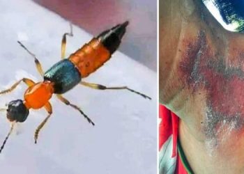 के हो नाइरोबी फ्लाई ? कहाँबाट फैलियो नेपालमा ?जोगिन के गर्ने ?