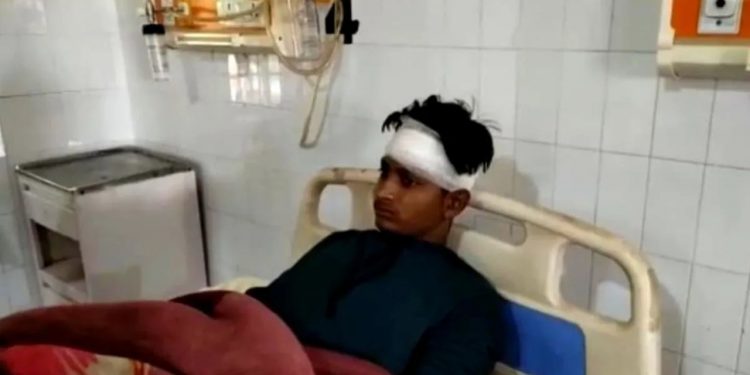 ‘घरमा कोही छैन, आउ’ भन्दै केटीले बोलाइन्, चोर भनेर मरणासन्न हुनेगरी कु टियो