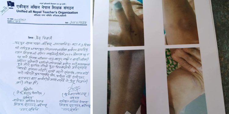 महोत्तरीमा शिक्षिका नै घरेलु हिं साको सिकार