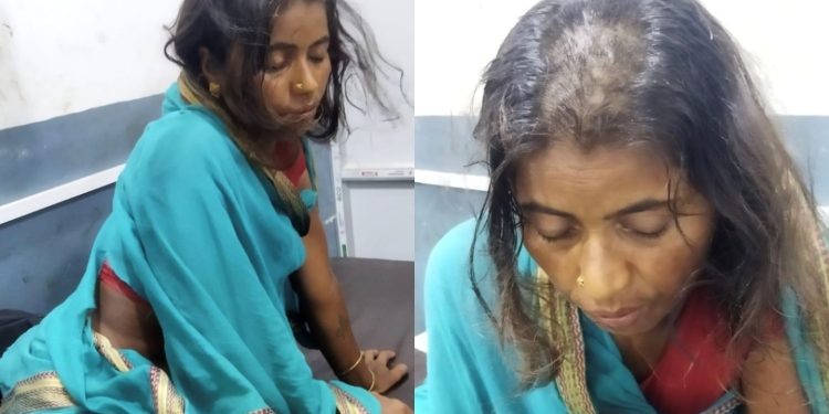 मधेस प्रदेश : बोक्सीको आरोपमा एकल महिलाको कपाल मुण्डन गरेर निर्घात कु टपिट