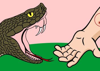 सर्पको टोकाइबाट जोगिन के गर्ने, सर्पले टोकिहाले के गर्ने ?