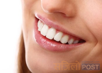 आज विश्व मुस्कान दिवस, मुस्काउनुको फाइदा के छ ? जानीराखौ