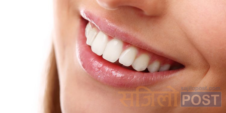 आज विश्व मुस्कान दिवस, मुस्काउनुको फाइदा के छ ? जानीराखौ