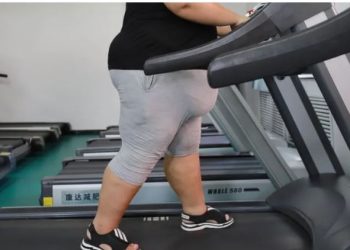 विश्वका एक अर्ब भन्दा बढी मानिसमा मोटोपनाः अनुसन्धान